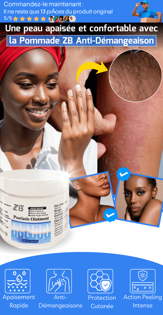 ZB 50g – Solution Rapide contre Démangeaisons et Irritations de la Peau - BOUTIQUE SN