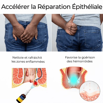 Spray anal pour le traitement des hémorroïdes à base de plantes - BOUTIQUE SN