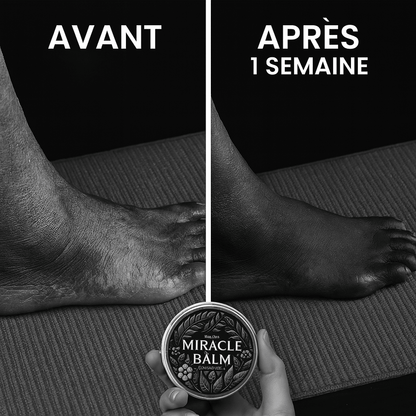 Miracle Balm – Soulage varices, jambes lourdes, douleurs et brûlures aux pieds, neuropathie dès la première application - BOUTIQUE SN