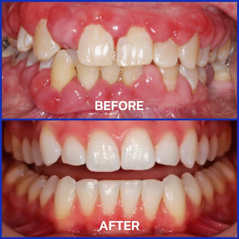 VioGloss™ Pro Dental Therapy – Formule Naturelle pour Gencives Saines et Haleine Fraîche - BOUTIQUE SN