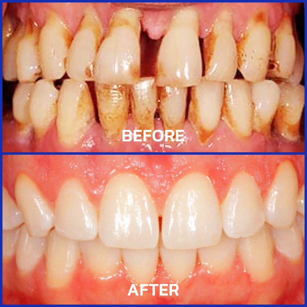 VioGloss™ Pro Dental Therapy – Formule Naturelle pour Gencives Saines et Haleine Fraîche - BOUTIQUE SN